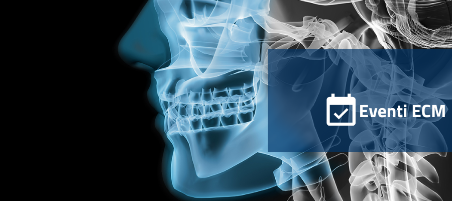 Clicca per accedere all'articolo Le neoplasie ossee dei mascellari